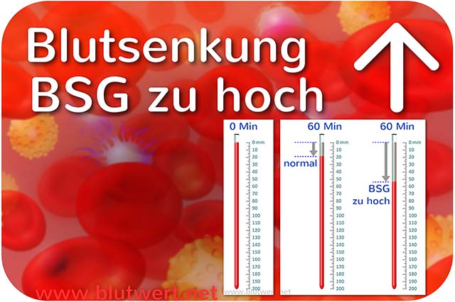 Blutwert BSG erhöht zu hoch Blutsenkung Ursachen